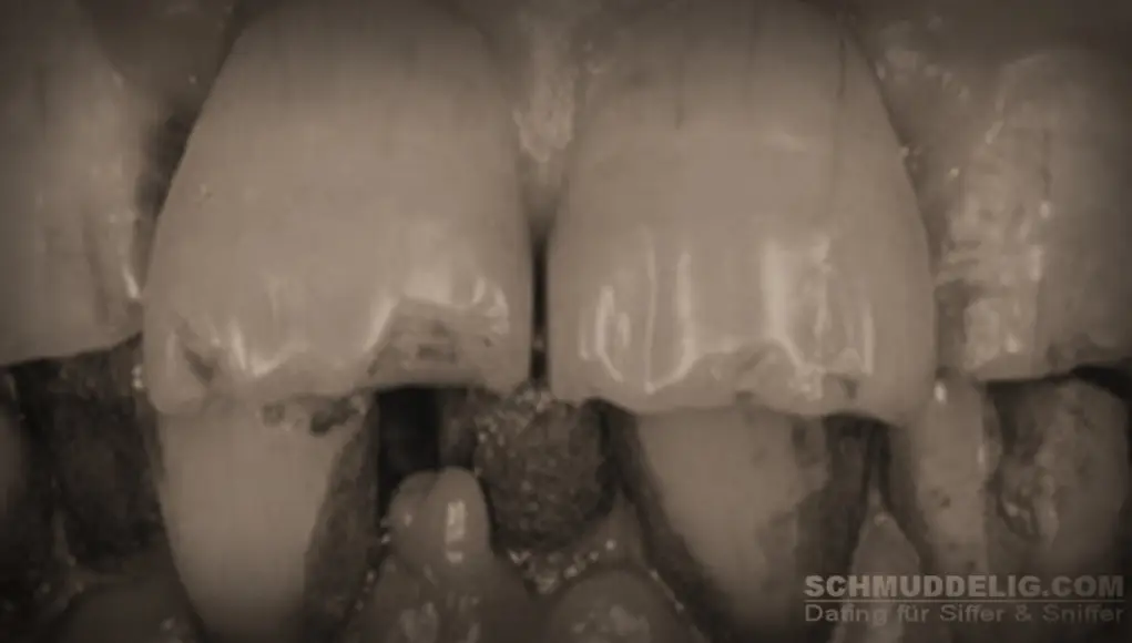 Gammelige Zähne und Mundgeruch