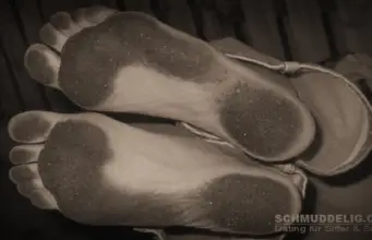 Schmutzige Füße mit dicker Hornhaut.